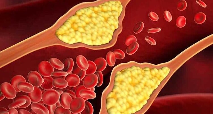 Що таке холестерин: правда про речовину