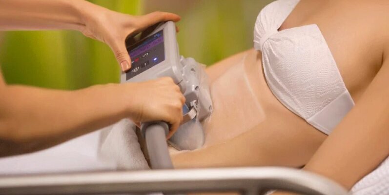 Кріоліполіз: що це таке і чому про нього говорить уся естетична медицина