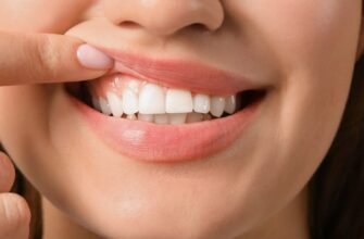 Пародонтит і запах з рота: що робити?