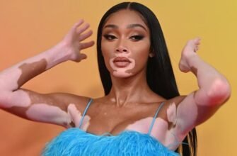 Що таке вітіліго: коли шкіра стає полотном без фарб