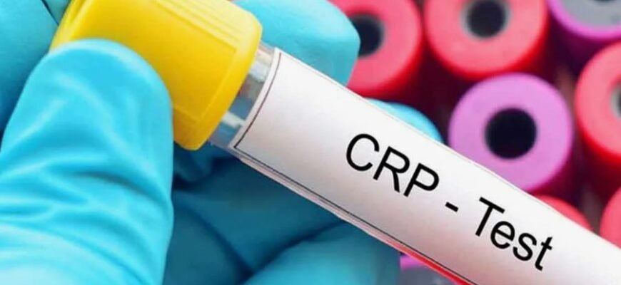 Що таке реактивний білок