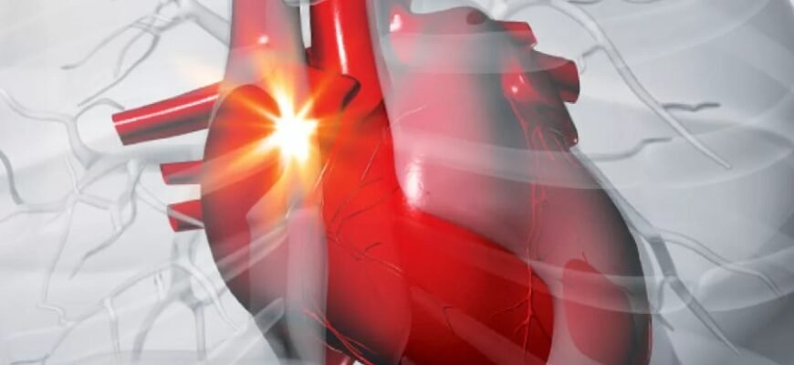 Що таке стенокардія і як розпізнати сигнал тривоги