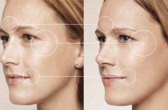 Біоревіталізація чи мезотерапія: що обрати для ідеальної шкіри?