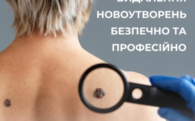 Чи безпечно багато ходити при варикозі: поради та рекомендації лікарів