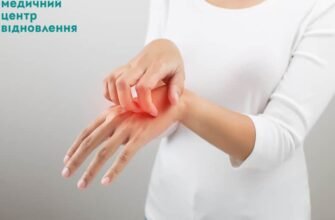 Чи боляче під час зняття швів: особливості та поради для пацієнтів