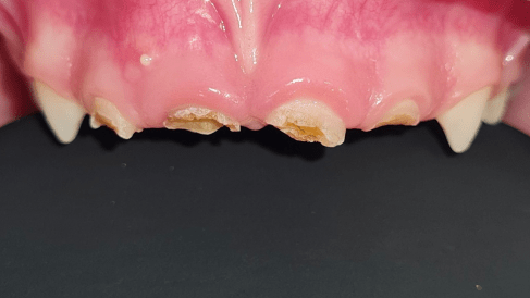 Чи дійсно молочні зуби мають нерви: повний огляд від стоматологів