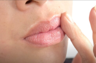 Чи дозволено вживати алкоголь після процедури збільшення губ: поради лікарів