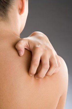 Чи є псоріаз заразною хворобою: відповіді на важливі питання