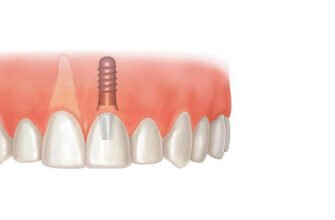 Чи може передаватися стоматит через поцілунок: що потрібно знати?