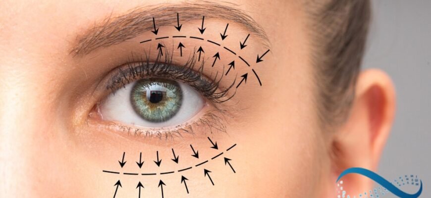 Чи може прорвати халязіон: симптоми, лікування та профілактика