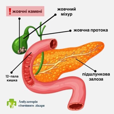 Чи може викликати щитовидка кашель: все про симптоми і причини