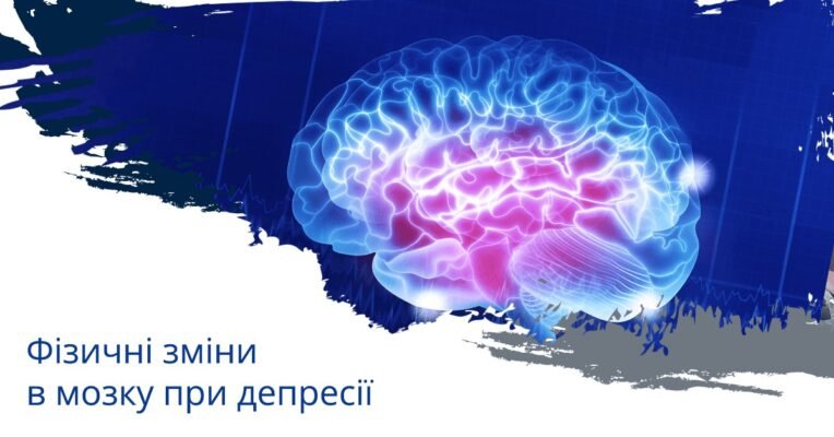 Чи можлива трансформація: депресія як перехід до шизофренії?