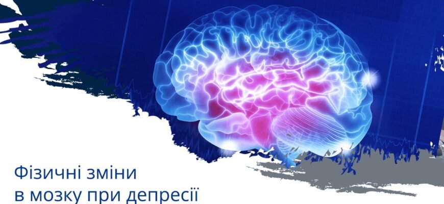 Чи можлива трансформація: депресія як перехід до шизофренії?