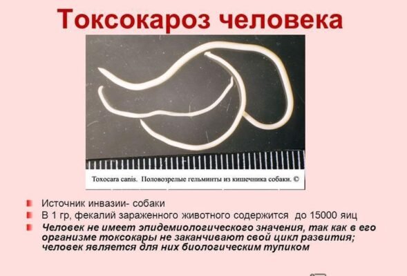 Чи можливе зараження токсокарозом від людини до людини: факти і міфи