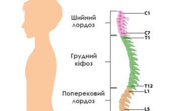 Чи можливо повністю вилікувати кіфоз: ефективні методи та результати