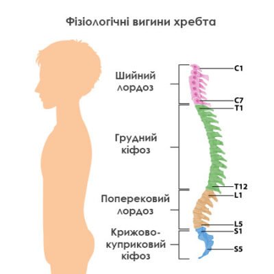Чи можливо повністю вилікувати кіфоз: ефективні методи та результати Чи можливо повністю вилікувати кіфоз: ефективні методи та результати