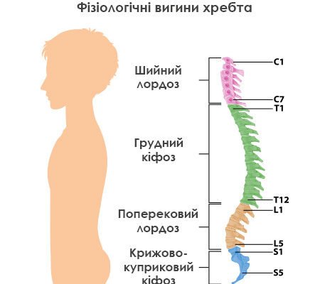 Чи можливо повністю вилікувати кіфоз: ефективні методи та результати