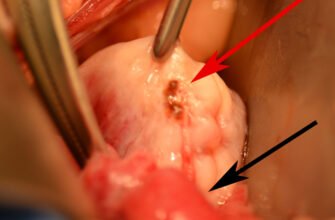Чи можна побачити ендометріоз на УЗД: особливості діагностики