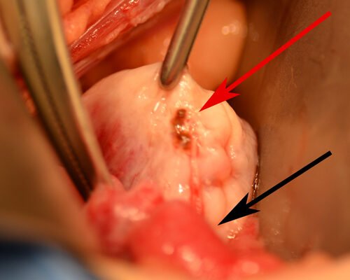 Чи можна побачити ендометріоз на УЗД: особливості діагностики