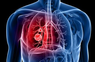 Чи можна повністю вилікувати ХОЗЛ: сучасні методи та рекомендації