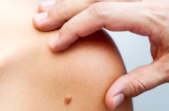 Чи можна вилікувати меланому ока: сучасні методи та перспективи лікування