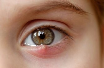 Чи можна заразитися ячменем на оці: міфи та реальність передачі