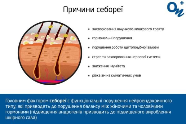 Чи заразний себорейний дерматит: правда про передачу захворювання