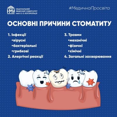 Чи заразний стоматит: все, що потрібно знати про ризики зараження Чи заразний стоматит: все, що потрібно знати про ризики зараження