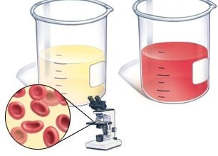 Чи змінюється колір сечі під час вагітності: що варто знати?