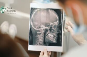 Флюорографія чи рентген: що обрати для діагностики легенів?