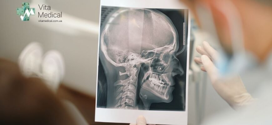 Флюорографія чи рентген: що обрати для діагностики легенів?