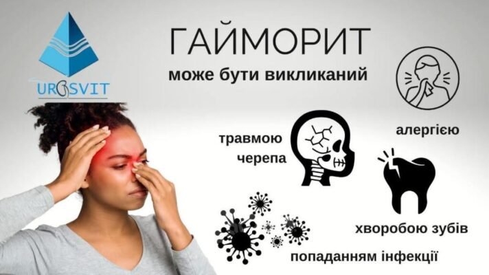 Гайморит без температури: чи можливий перебіг захворювання? Гайморит без температури: чи можливий перебіг захворювання?