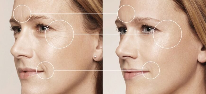 Мезотерапія чи біоревіталізація: що обрати для омолодження шкіри? Мезотерапія чи біоревіталізація: що обрати для омолодження шкіри?