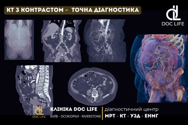 МРТ з контрастом чи без: як обрати оптимальний метод діагностики