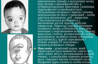 Вроджені вади розвитку: причини, види та сучасні методи лікування