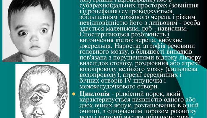 Вроджені вади розвитку: причини, види та сучасні методи лікування