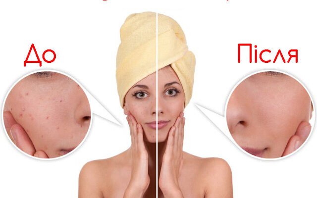 Ефективний пілінг в домашніх умовах: покрокова інструкція для сяючої шкіри