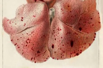 Загадкові плями Тардьє: причини та методи виявлення після смерті