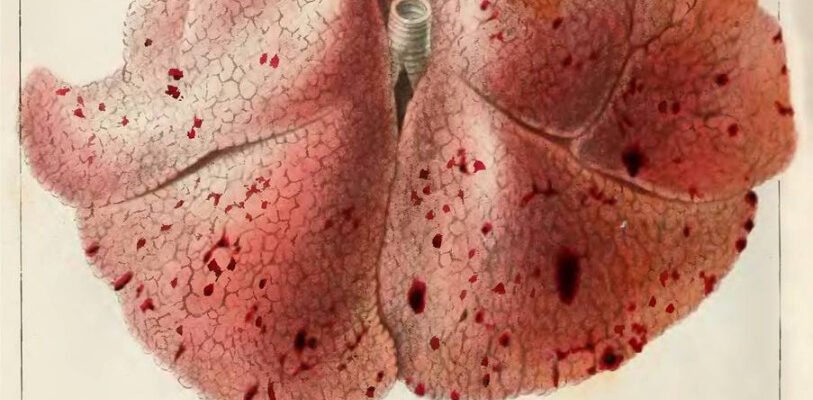 Загадкові плями Тардьє: причини та методи виявлення після смерті