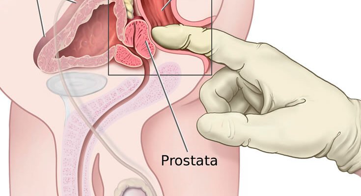 Ефективний посібник: Як самостійно виконати масаж простати вдома
