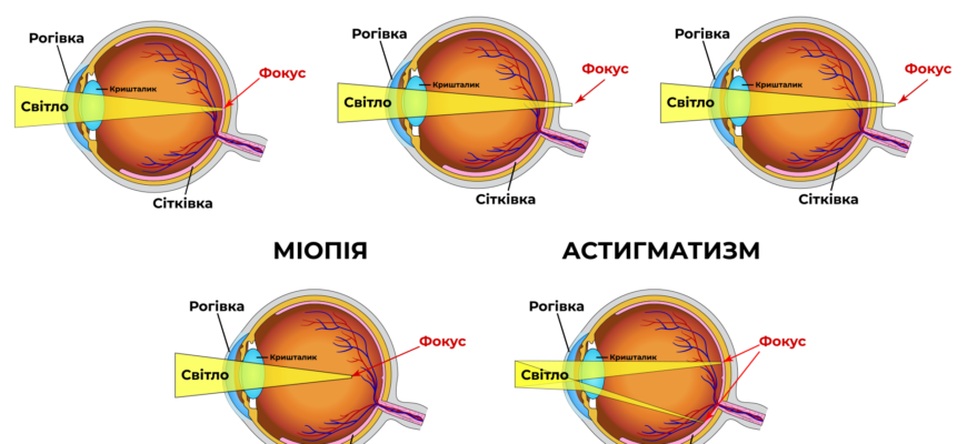 Що таке рефракція: розуміння процесу заломлення світла
