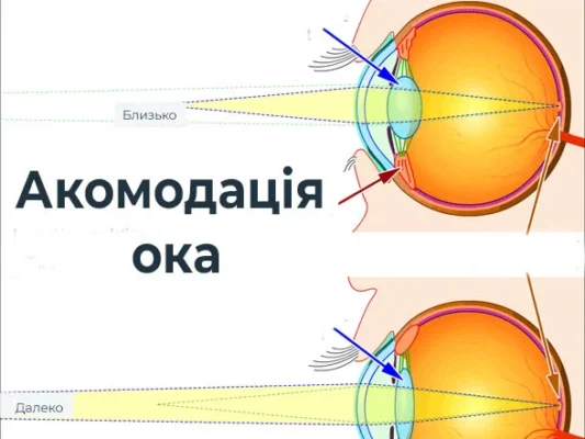 Акомодація зору: розуміння процесу та його значення для здоров’я очей