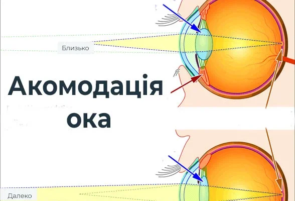 Акомодація зору: розуміння процесу та його значення для здоров’я очей