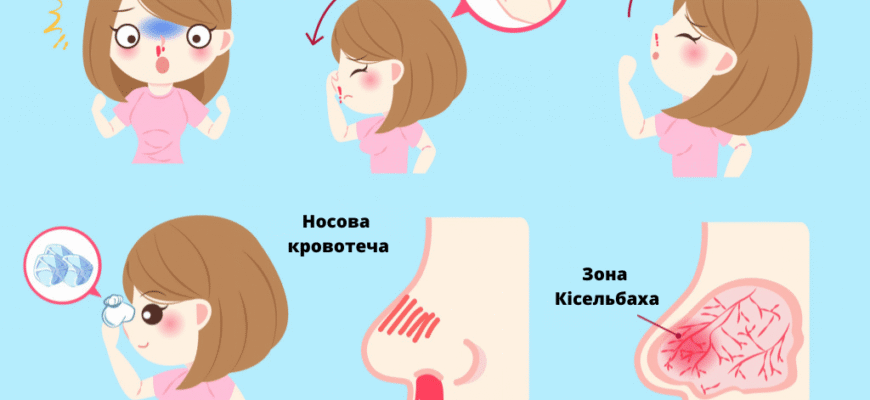 Як безпечно та швидко викликати кров з носа: поради та застереження