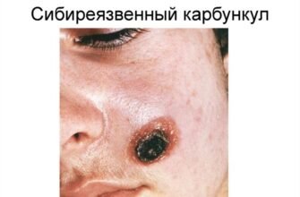 Больовий синдром за МКХ-10: Класифікація та Лікування Симптомів