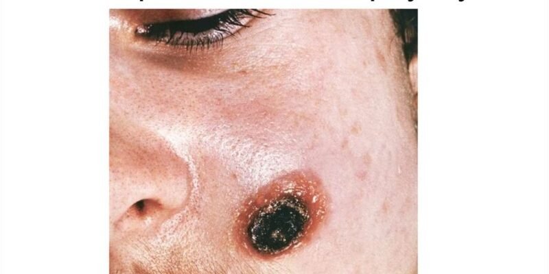 Больовий синдром за МКХ-10: Класифікація та Лікування Симптомів