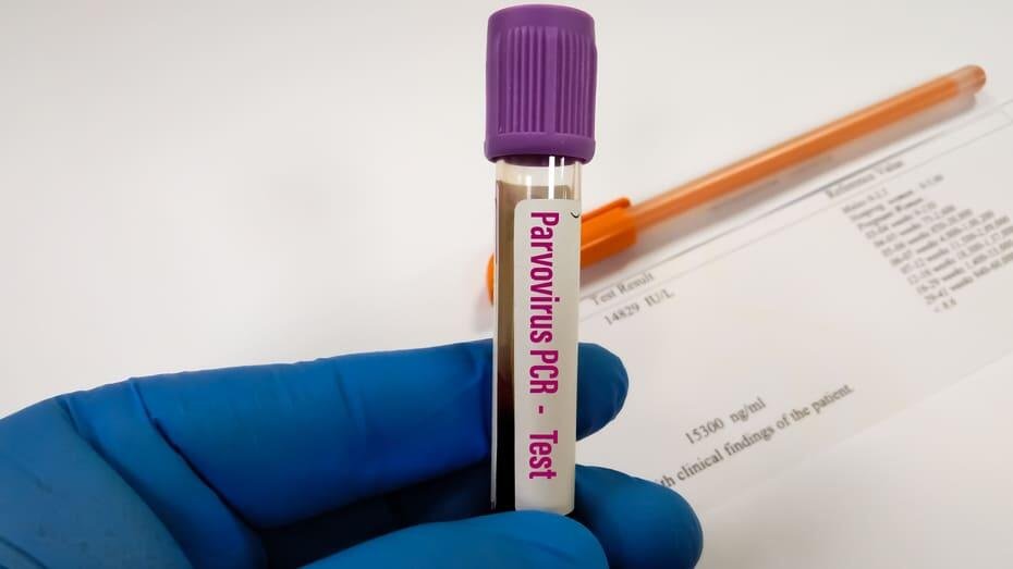 пробірка в руці