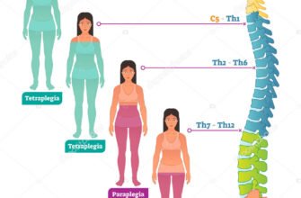 Тетраплегія: причини, симптоми та сучасні методи лікування