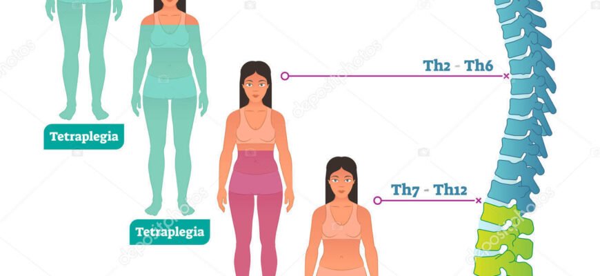 Тетраплегія: причини, симптоми та сучасні методи лікування