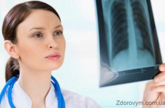 Дресс-синдром: Симптоми, діагностика та ефективні методи лікування